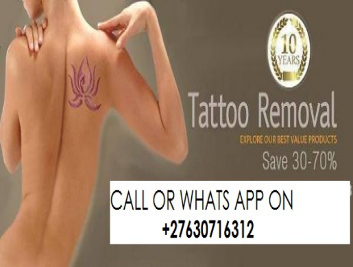  4 IN 1 NATURAL Tattoo Removal Cream for sale CALL ON +27(63)0716312 IN SOUTH AFRICA, Alberton -  South Africa