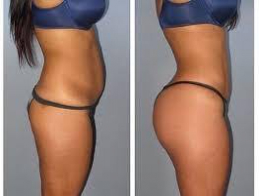 {{{[HOW TO  ENLARGE HIPS AND BUMS + Botcho, BREAST  Skin Lightening Pills and penis enlargment   QUICK RESULTS +27785167256}}}, Nairobi -  Kenya