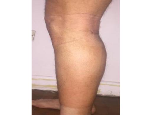 100% herbal legs,hips, body and skin products call +256777422022, Brazzaville -  Congo