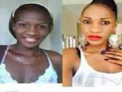 Skin Lightening/ Whitening [Bleaching]Products in South Africa +27678276964, Johannesburg -  South Africa